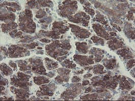 Monoclonal Mouse anti-Human GORAB / SCYL1BP1 Antibody (clone OTI1E3, aa35-394, IHC, WB)