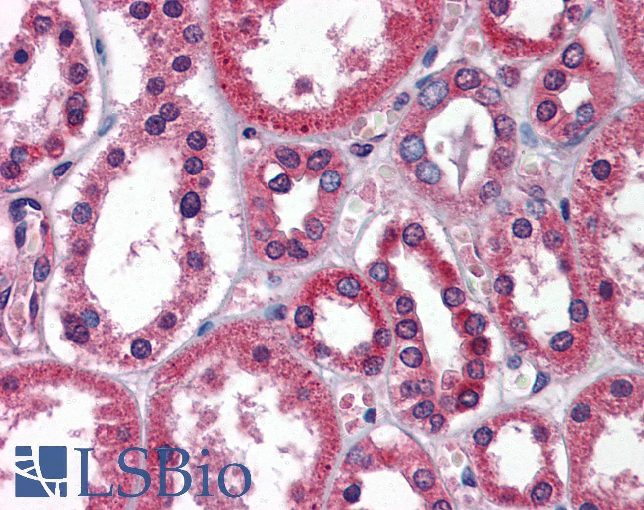 TBC1 / TBC1D1 Antibody (aa612-661)