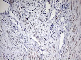 CD5 Antibody (clone OTI10F4)