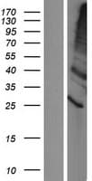 TMEM86A Protein (Over-Expression Lysate Myc-DDK (Flag))