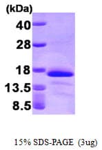 Human GLRX2 / Glutaredoxin 2 Protein (Recombinant His)