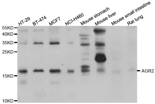 AGR2 Antibody