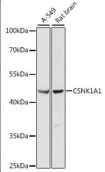 IHC-plus™ CSNK1A1 / CK1 Alpha Antibody (aa100-200)