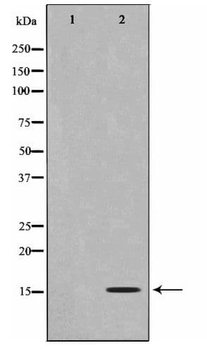 Polyclonal Rabbit anti-Human Histone H2B Antibody (IHC, WB)