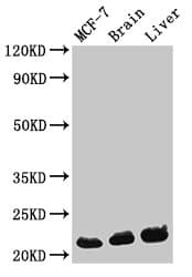 HIST1H1C Antibody