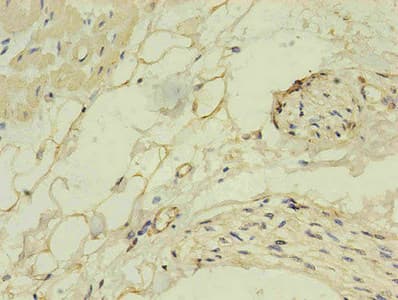 NPPB / BNP Antibody (clone 1E1F4)