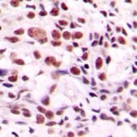 CSTF2 / CstF-64 Antibody (N-Terminus)
