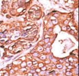PPM1F Antibody (aa11-40)