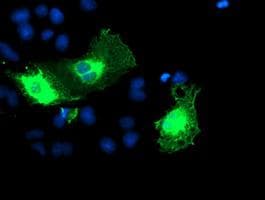Monoclonal Mouse anti-Human ERBB2 / HER2 Antibody (clone OTI12G4, Carrier-free, aa676-1255, IHC, IF, WB)