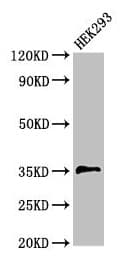 PPT1 / CLN1 Antibody