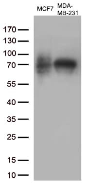 MAPT / Tau Antibody (aa623-758, clone OTI13B5)