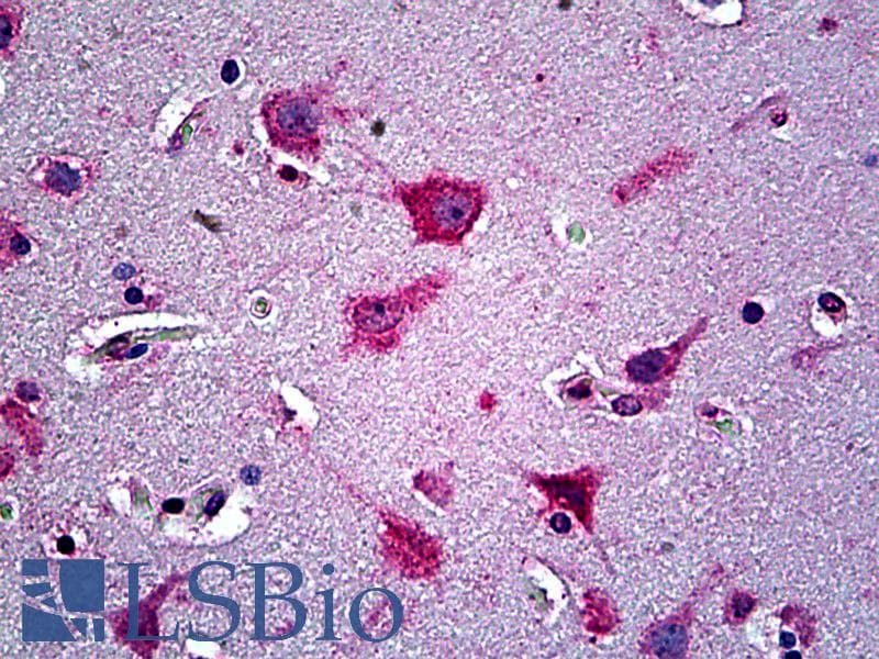 IHC-plus™ EFNA5 / Ephrin A5 Antibody (aa189-200)