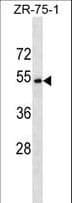 CCDC112 / MBC1 Antibody (aa1-30)
