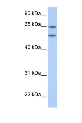 HTR2A / 5-HT2A Receptor Antibody (N-Terminus)