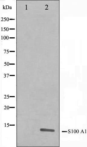 Polyclonal Rabbit anti-Human S100A1 / S100-A1 Antibody (IHC, IF, WB)