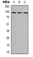 FAK / Focal Adhesion Kinase Antibody (phospho-Tyr407)