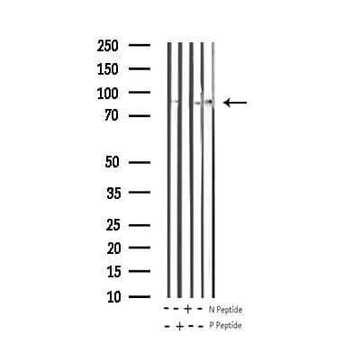 MAPT / Tau Antibody (phospho-Ser214)