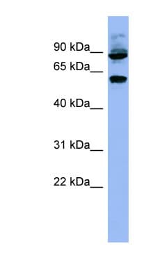 RPS6KB1 / P70S6K / S6K Antibody (N-Terminus)