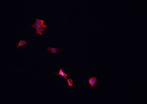 TNFRSF1B / TNFR2 Antibody
