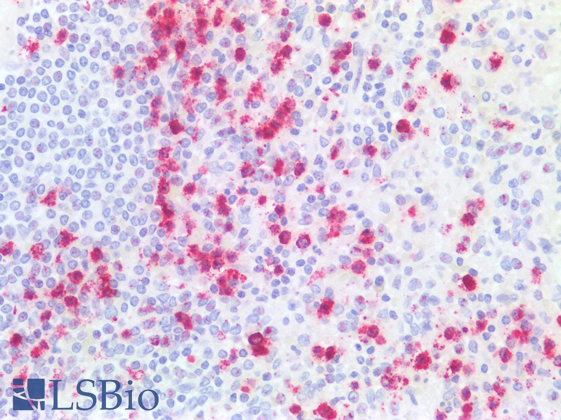 PathPlus™ CTSG / Cathepsin G Antibody