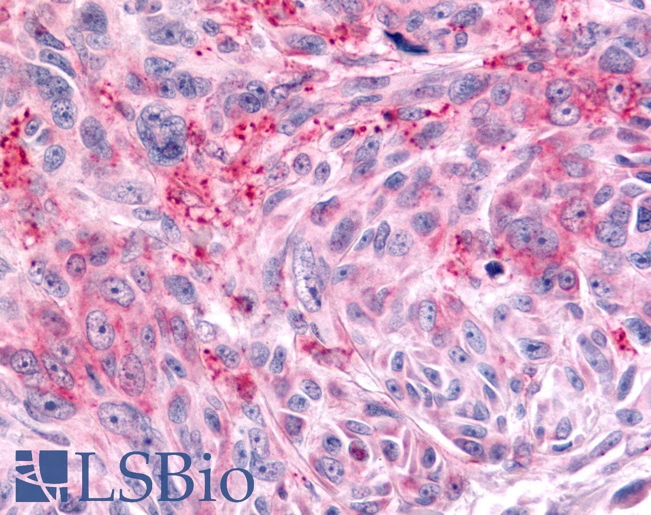 PathPlus™ Polyclonal Rabbit anti-Human PTPRE / PTP Epsilon Antibody (Cytoplasmic Domain, IHC)