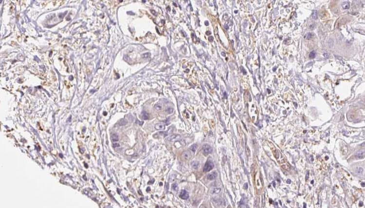NPY4R / PPYR1 Antibody