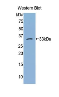 Polyclonal Rabbit anti-Human BLMH Antibody (Biotin, aa213-447, WB)