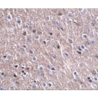 C16orf5 / I1 Antibody