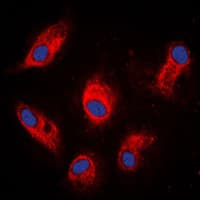 IVL / Involucrin Antibody (C-Terminus)