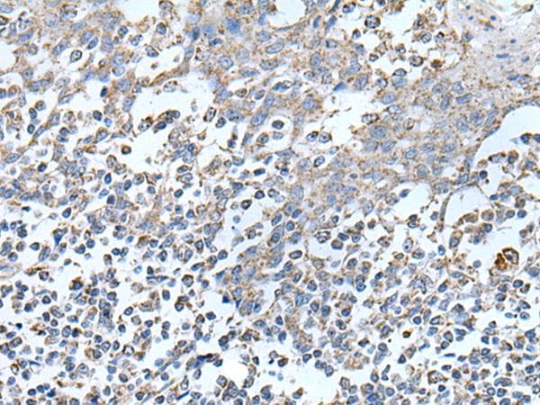 Polyclonal Rabbit anti-Human IRF5 Antibody (IHC, WB)