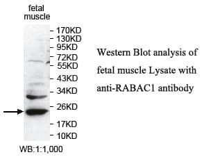 RABAC1 Antibody (aa1-185)