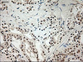 Monoclonal Mouse anti-Human L1CAM Antibody (clone OTI10C12, IHC, WB)