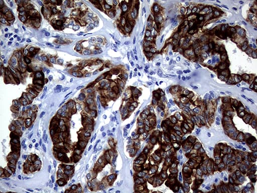 KRT18 / CK18 / Cytokeratin 18 Antibody (aa69-372, clone OTI10G8)