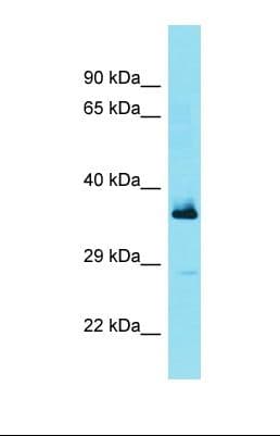 FBXL15 Antibody (N-Terminus)