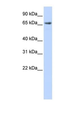 DLG3 / SAP102 Antibody (aa108-157)