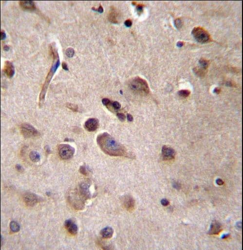 Polyclonal Rabbit anti-Human TSN / Translin Antibody (aa109-138, IHC, IF, WB)