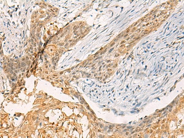 Polyclonal Rabbit anti-Human TBCK / TBCKL Antibody (IHC)