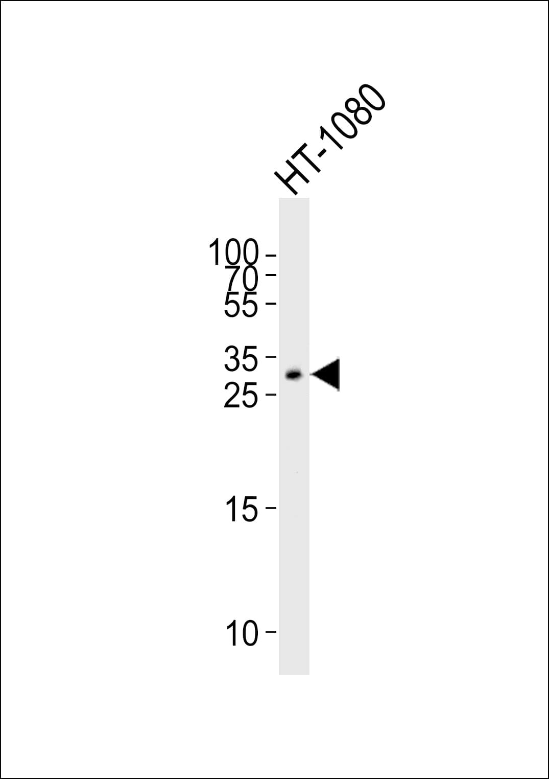 GDF15 Antibody (aa258-293)