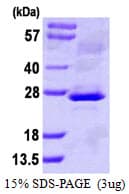 Human CLCF1 Protein (Recombinant His)