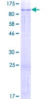 Human FAM111A Protein (Recombinant GST)