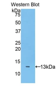 ADAMTS7 Antibody (aa1589-1686)