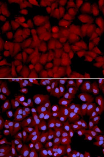 IHC-plus™ Polyclonal Rabbit anti-Human PPP1CB Antibody (IHC, IF, WB)