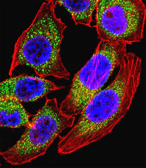 Polyclonal Rabbit anti-Human NFATC4 / NFAT3 Antibody (aa744-773, IF, WB)