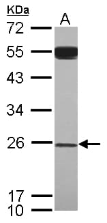 GAS41 Antibody