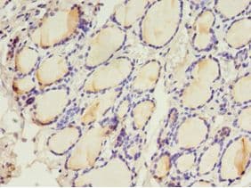 LHCGR / LHR / LH Receptor Antibody (aa27-363)