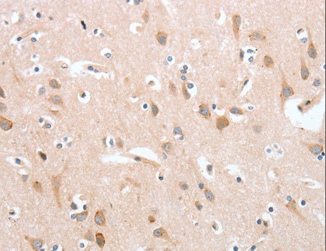 Polyclonal Rabbit anti-Human cPLA2 Antibody (IHC)