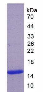 Human ADAMTS7 Protein (Recombinant His)