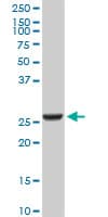 Monoclonal Mouse anti-Human GSTA2 Antibody (clone 3D4, IF, WB)