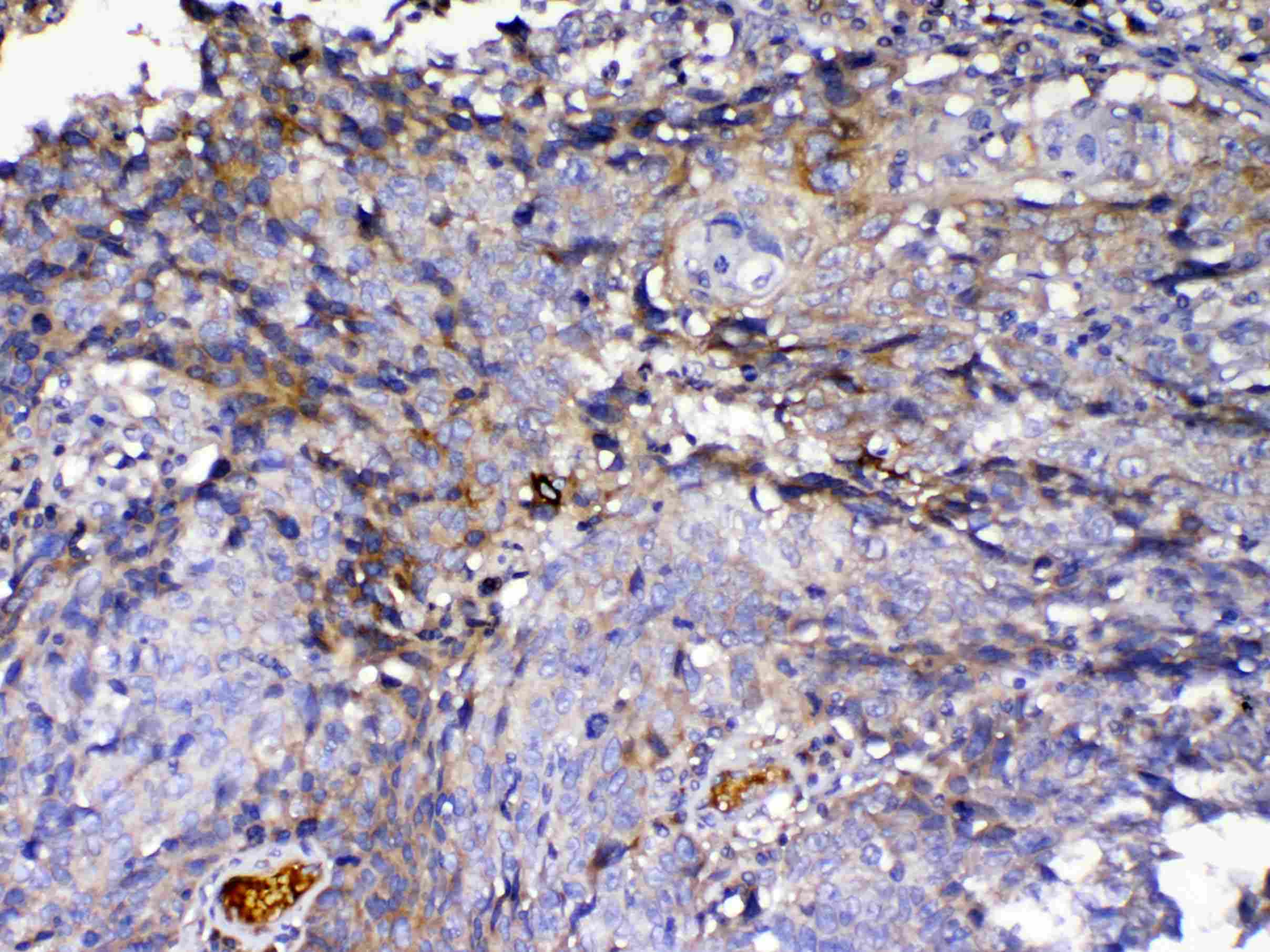 IGFBP2 / IGF-BP53 Antibody