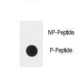 Polyclonal Rabbit anti-Human PLXND1 / Plexin D1 Antibody (phospho-Tyr1642)